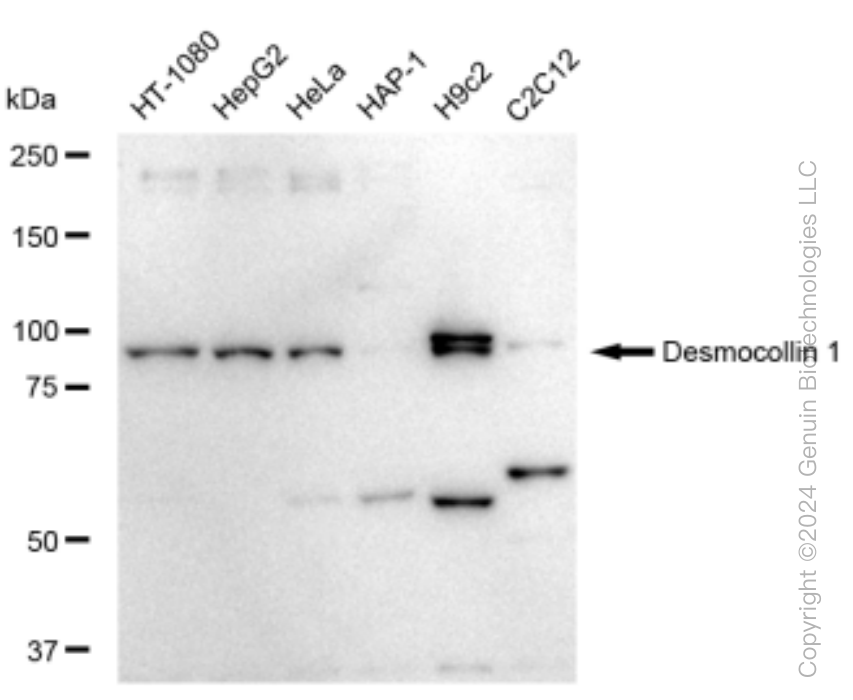 KD-Validated Anti-Desmocollin 1 Rabbit Monoclonal Antibody ABG1507