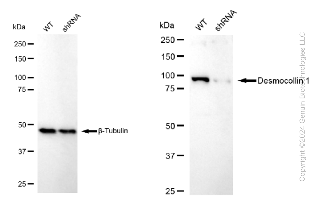 KD-Validated Anti-Desmocollin 1 Rabbit Monoclonal Antibody ABG1507