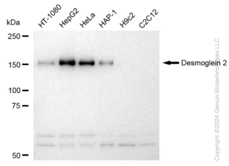 KD-Validated Anti-Desmoglein 2 Rabbit Monoclonal Antibody ABG1508