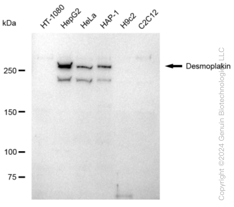 KD-Validated Anti-Desmoplakin Rabbit Monoclonal Antibody ABG1509