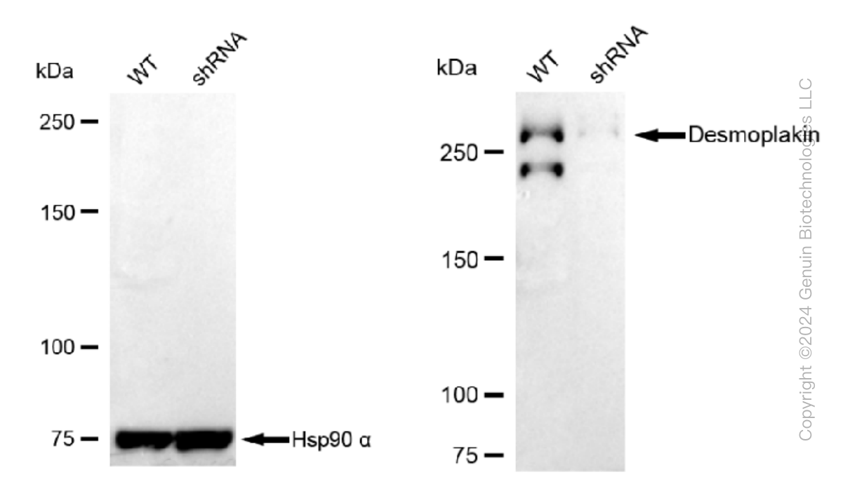 KD-Validated Anti-Desmoplakin Rabbit Monoclonal Antibody ABG1509