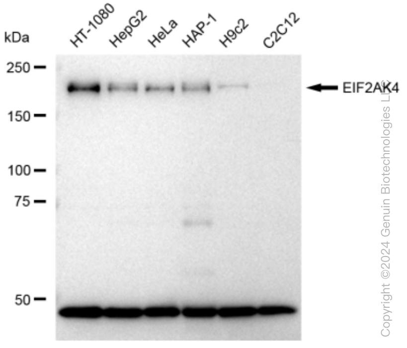 KD-Validated Anti-EIF2AK4 Rabbit Monoclonal Antibody ABG1515