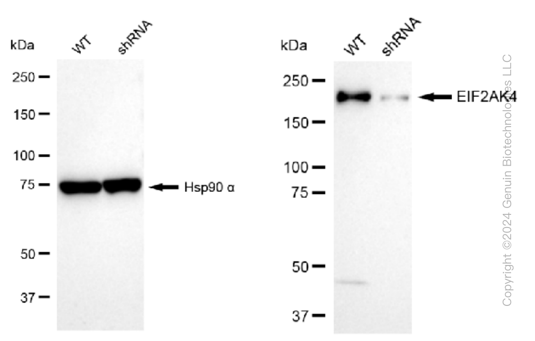 KD-Validated Anti-EIF2AK4 Rabbit Monoclonal Antibody ABG1515