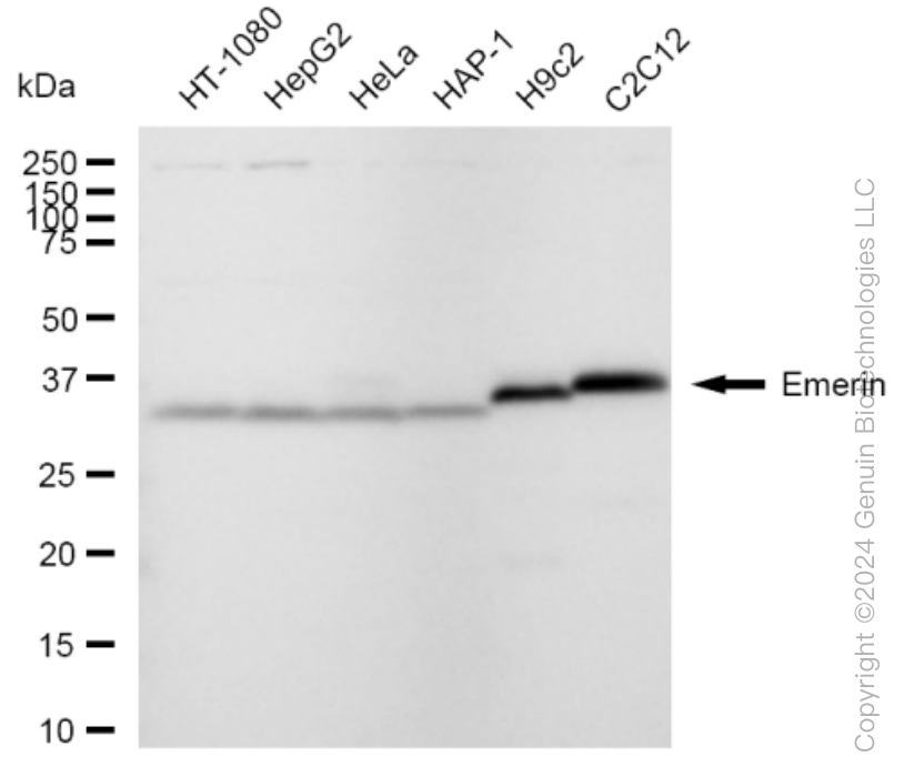 KD-Validated Anti-Emerin Rabbit Monoclonal Antibody ABG1517