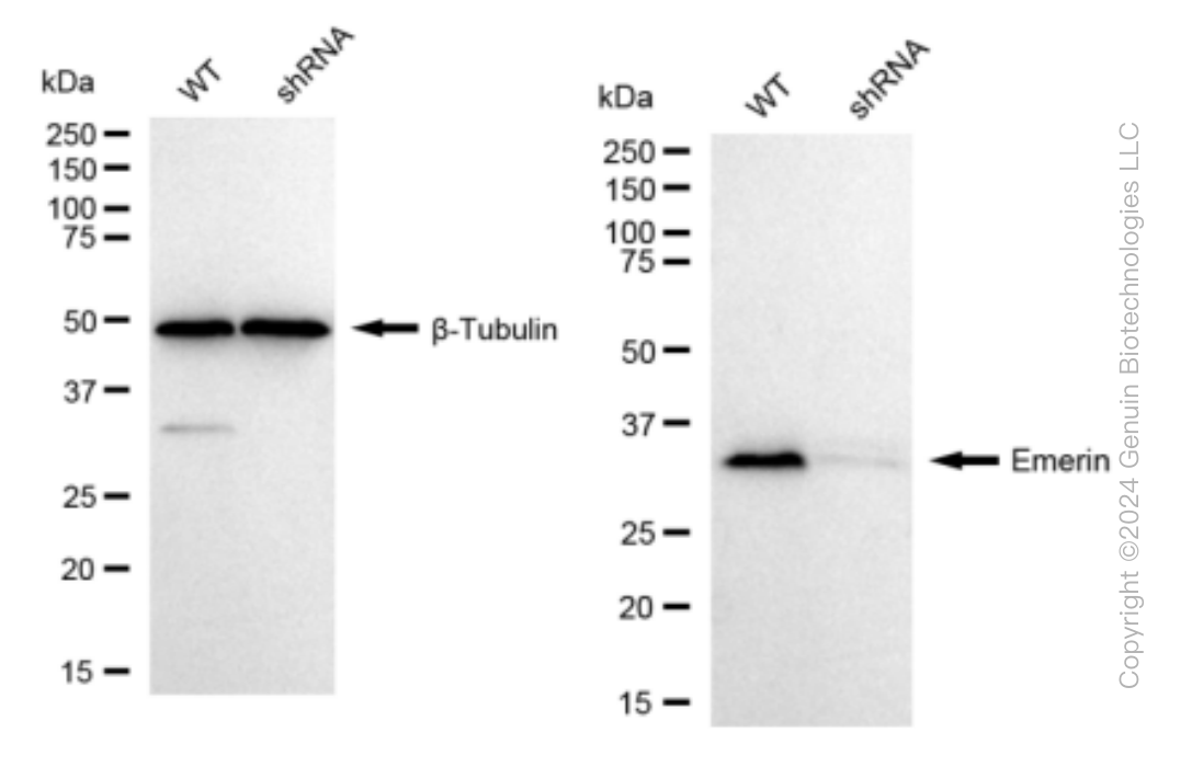 KD-Validated Anti-Emerin Rabbit Monoclonal Antibody ABG1517