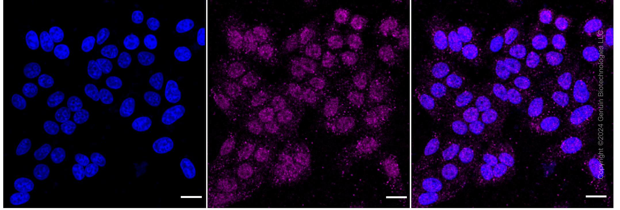 KD-Validated Anti-Aminopeptidase A / CD249 Rabbit Monoclonal Antibody ABG1518