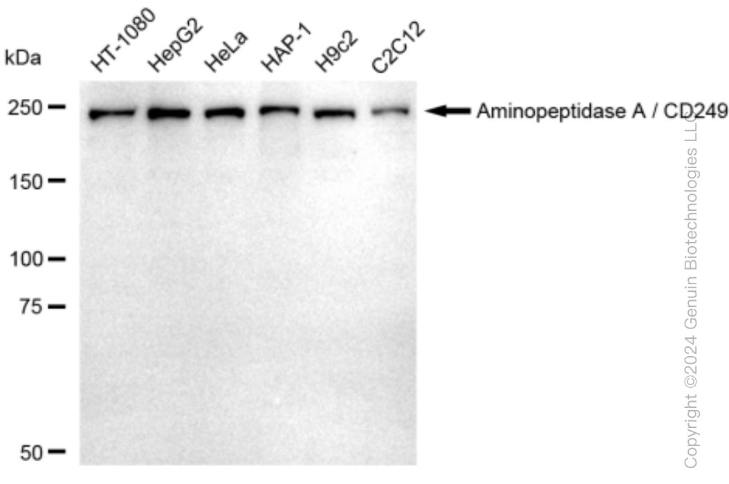 KD-Validated Anti-Aminopeptidase A / CD249 Rabbit Monoclonal Antibody ABG1518