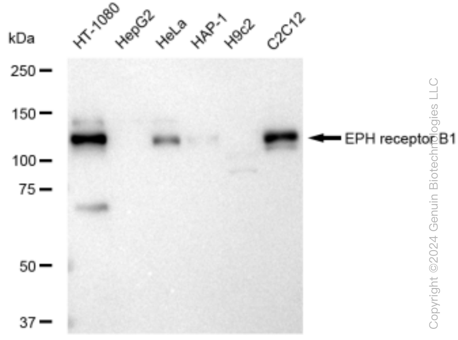 KD-Validated Anti-Eph receptor B1 Rabbit Monoclonal Antibody ABG1519