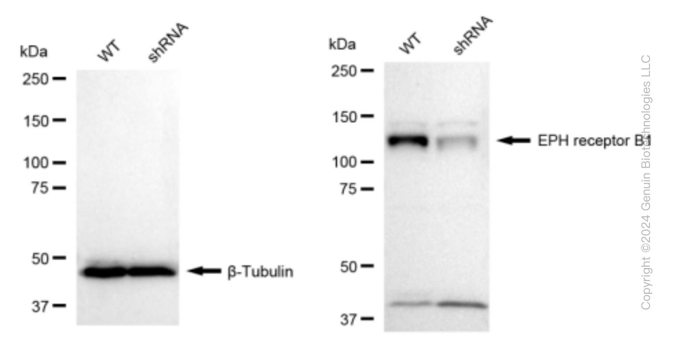 KD-Validated Anti-Eph receptor B1 Rabbit Monoclonal Antibody ABG1519