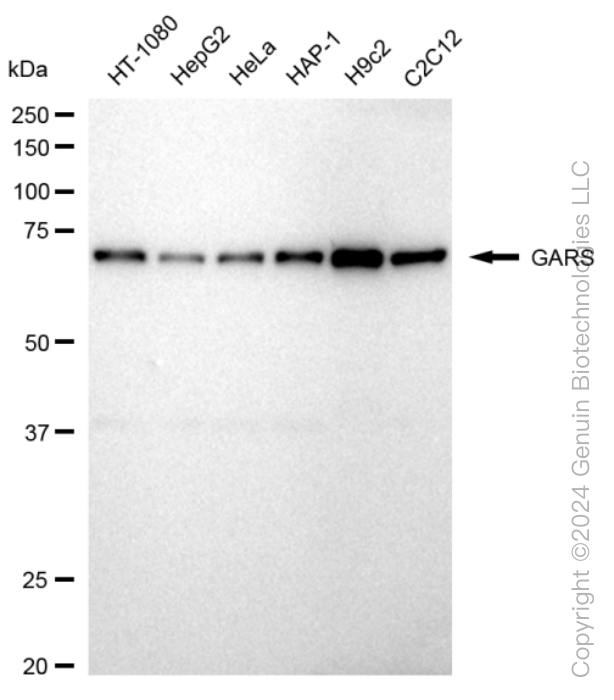 KD-Validated Anti-GARS Rabbit Monoclonal Antibody ABG1521