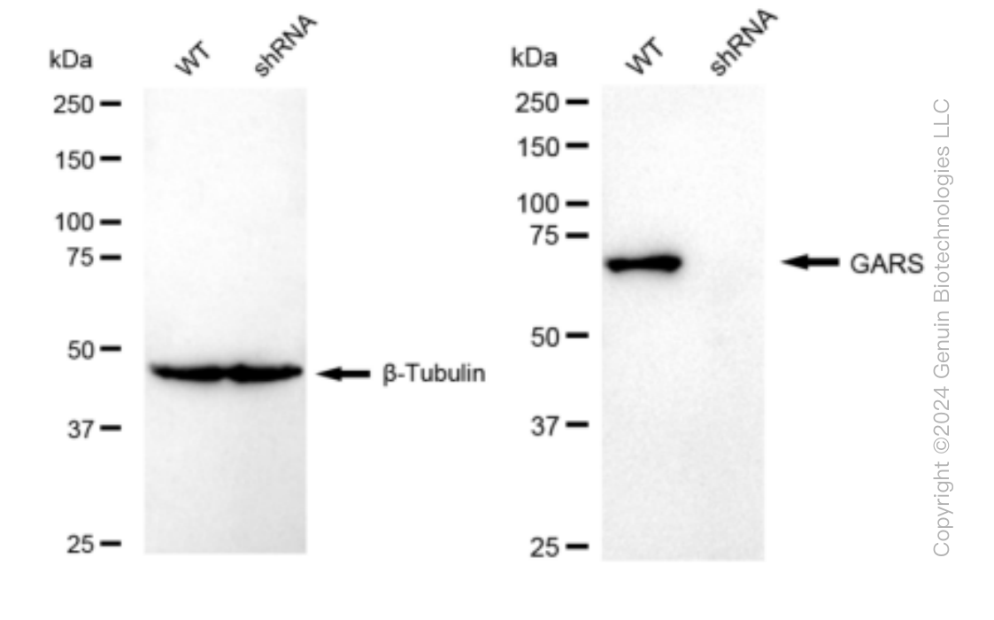 KD-Validated Anti-GARS Rabbit Monoclonal Antibody ABG1521