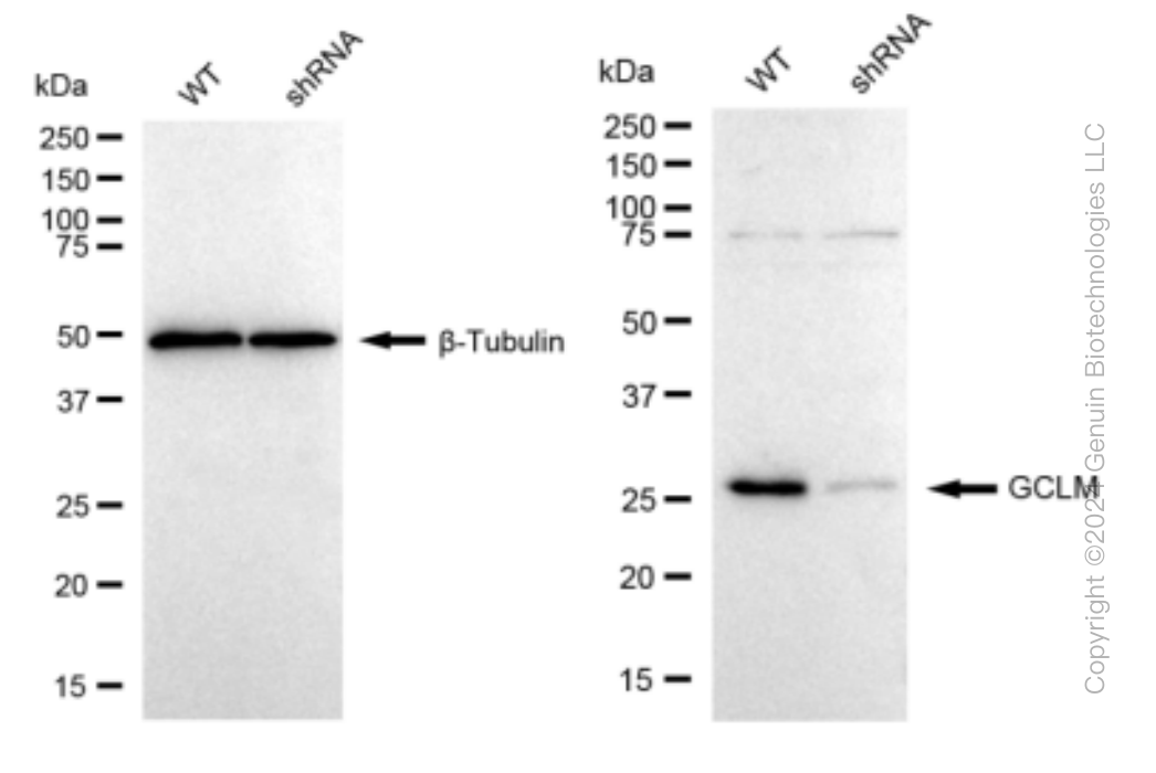KD-Validated Anti-GCLM Rabbit Monoclonal Antibody ABG1522