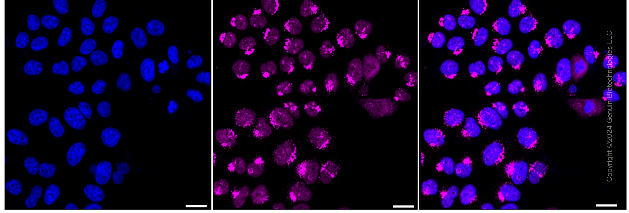 KD-Validated Anti-Golgin A2 Rabbit Monoclonal Antibody ABG1525