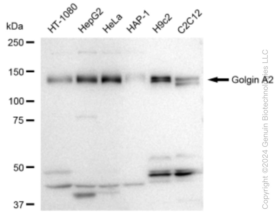 KD-Validated Anti-Golgin A2 Rabbit Monoclonal Antibody ABG1525