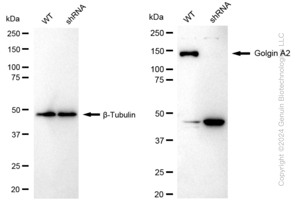 KD-Validated Anti-Golgin A2 Rabbit Monoclonal Antibody ABG1525