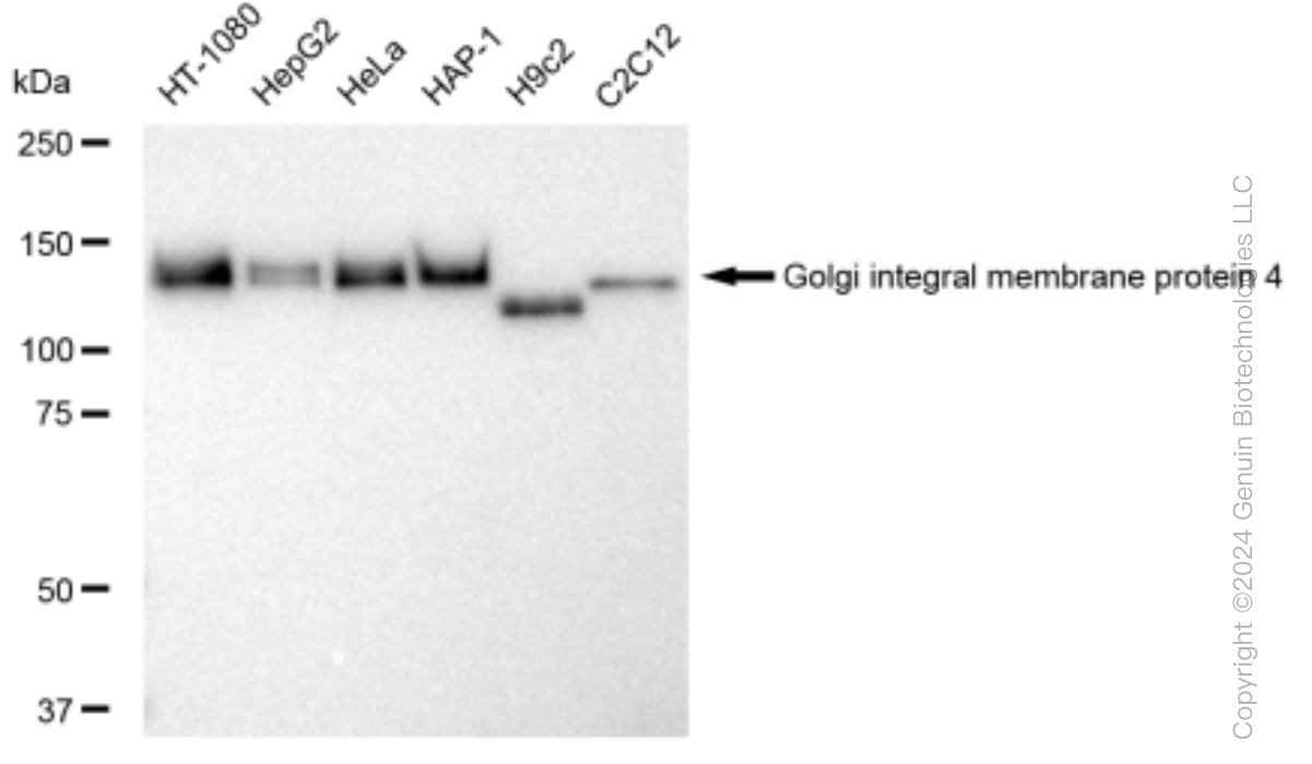 KD-Validated Anti-Golgi integral membrane protein 4 Rabbit Monoclonal Antibody ABG1526