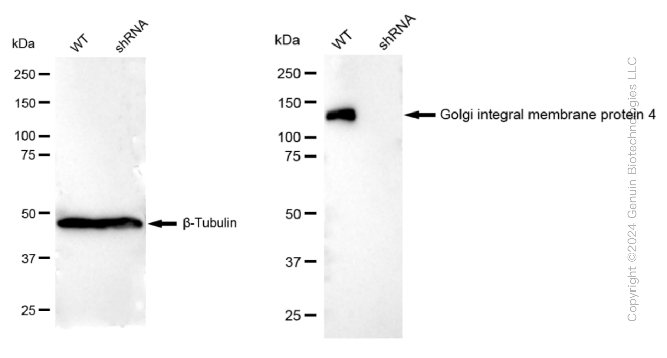 KD-Validated Anti-Golgi integral membrane protein 4 Rabbit Monoclonal Antibody ABG1526