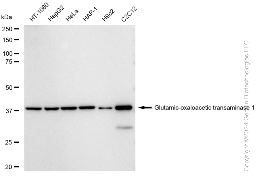 KD-Validated Anti-Glutamic-oxaloacetic transaminase 1 Rabbit Monoclonal Antibody ABG1528