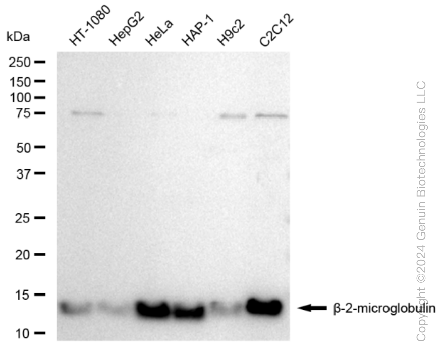 KD-Validated Anti-beta 2 Microglobulin Rabbit Monoclonal Antibody ABG1534