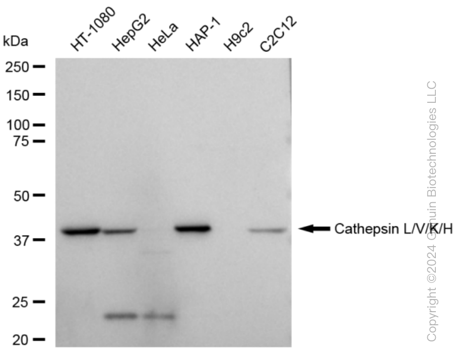 KD-Validated Anti-Cathepsin L/V/K/H Rabbit Monoclonal Antibody ABG1539