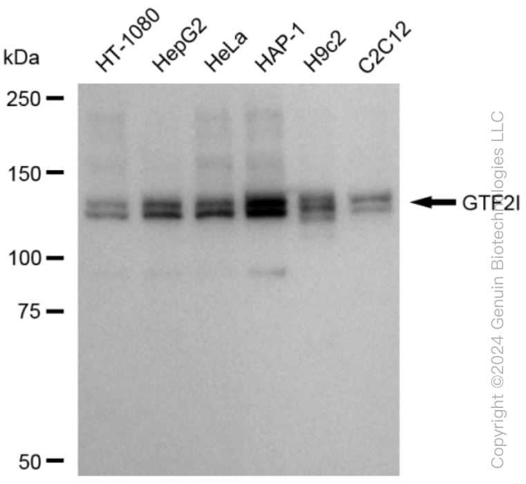 KD-Validated Anti-GTF2I Rabbit Monoclonal Antibody ABG1545