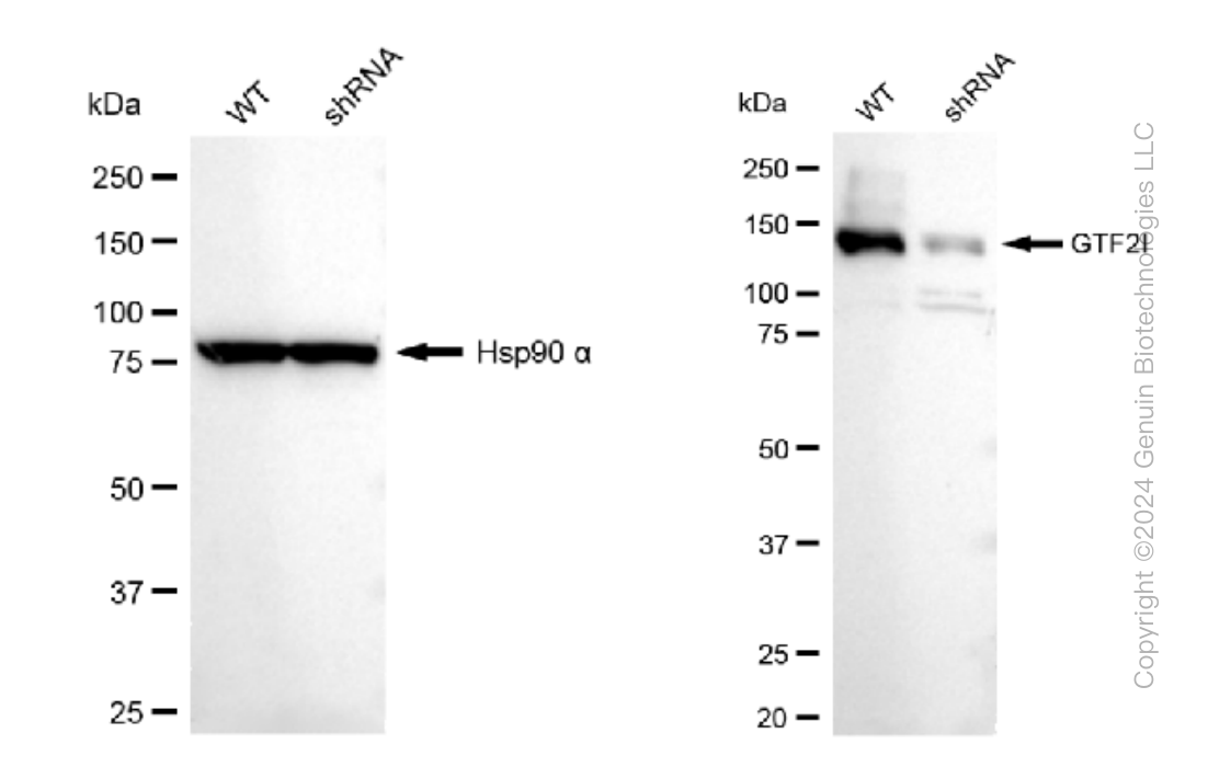KD-Validated Anti-GTF2I Rabbit Monoclonal Antibody ABG1545