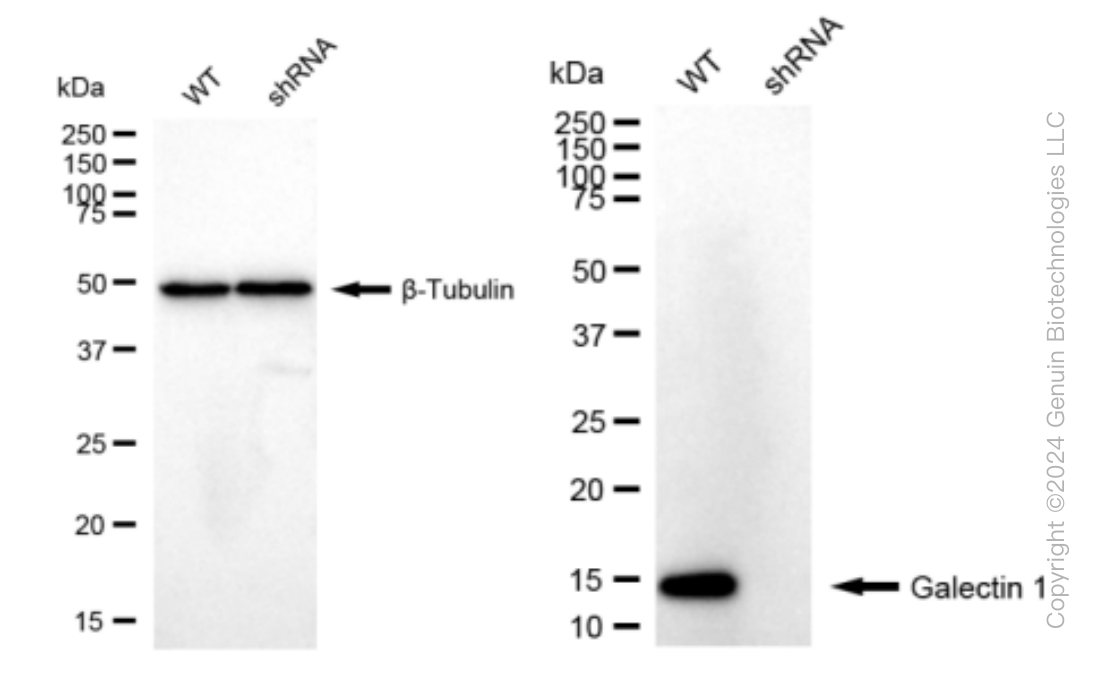 KD-Validated Anti-Galectin 1 Rabbit Monoclonal Antibody ABG1547