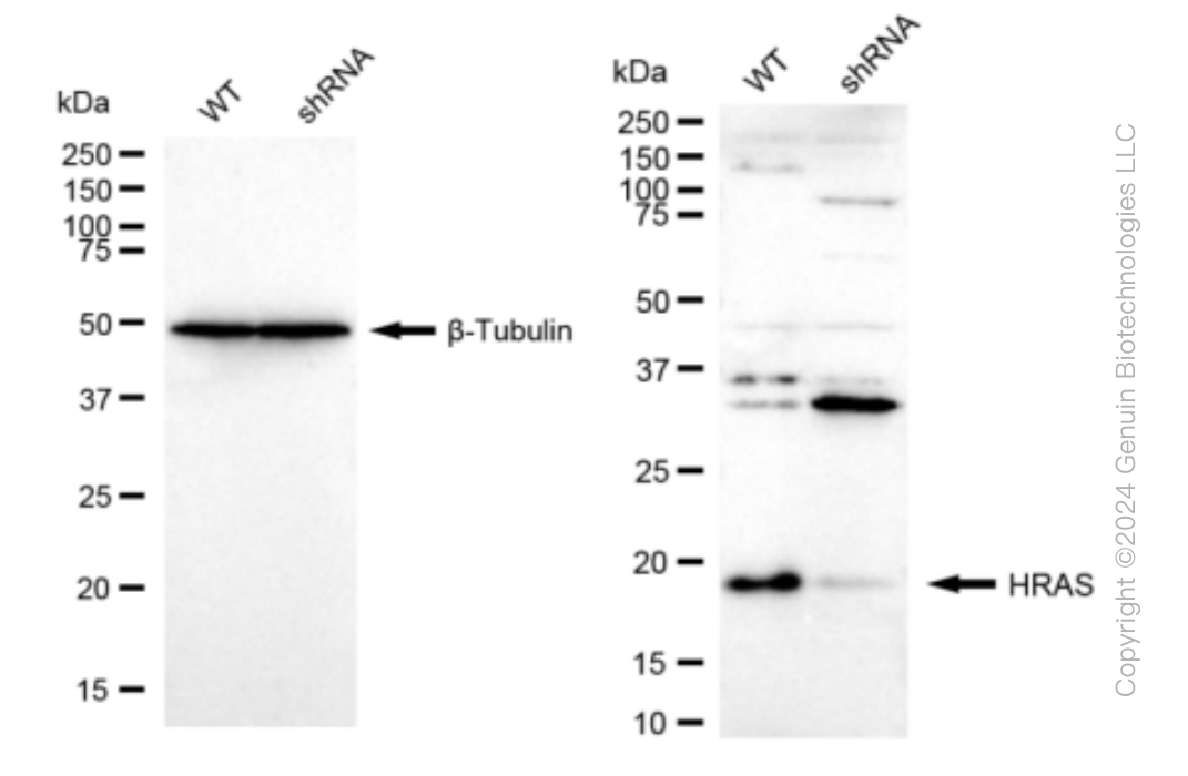 KD-Validated Anti-HRAS Rabbit Monoclonal Antibody ABG1548
