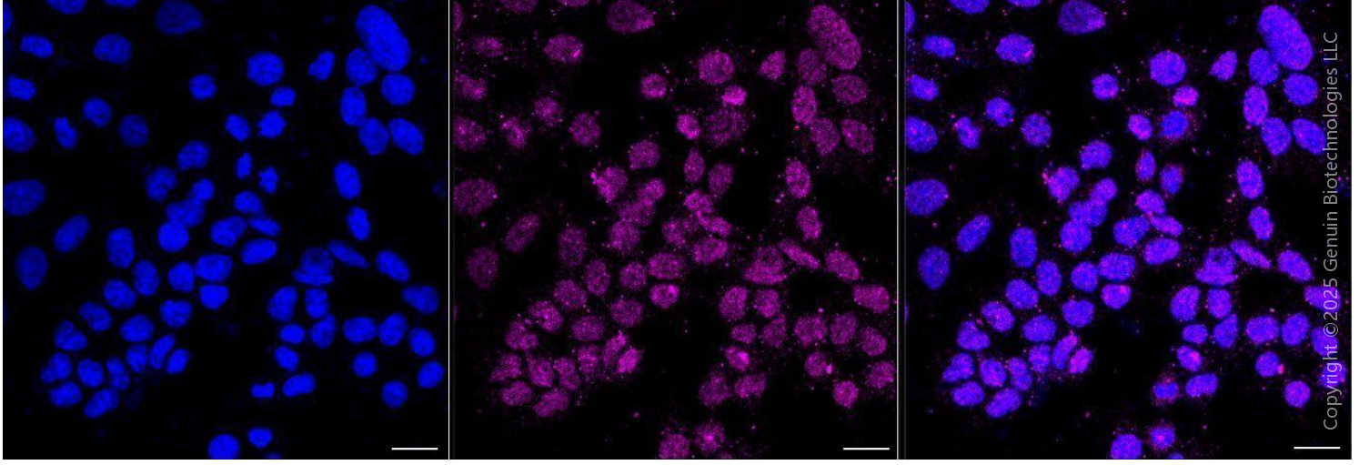KD-Validated Anti-Keratin 10 Rabbit Monoclonal Antibody ABG1550