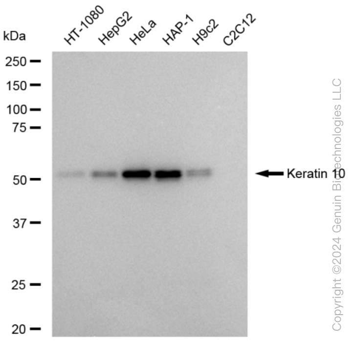 KD-Validated Anti-Keratin 10 Rabbit Monoclonal Antibody ABG1550