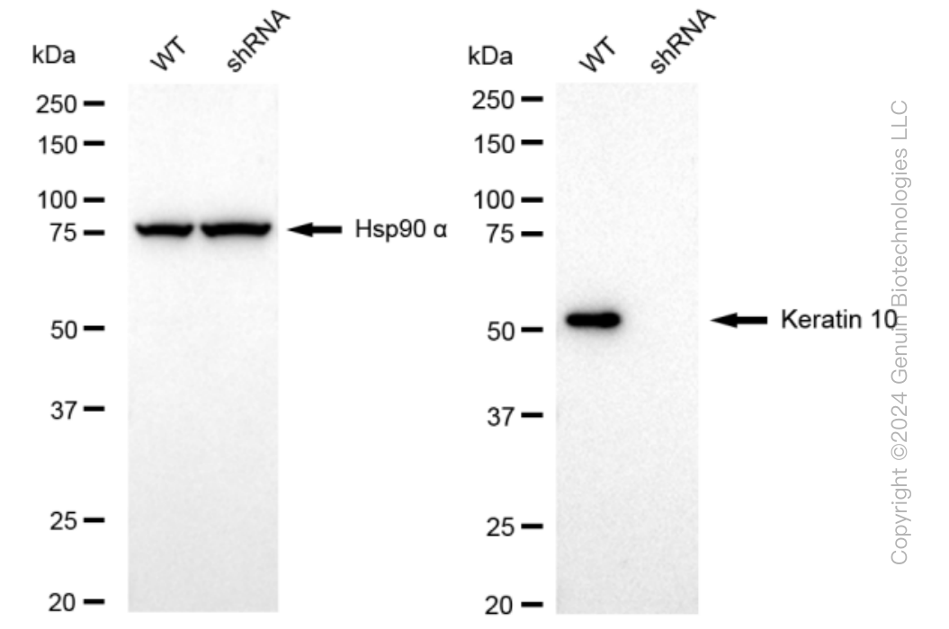 KD-Validated Anti-Keratin 10 Rabbit Monoclonal Antibody ABG1550