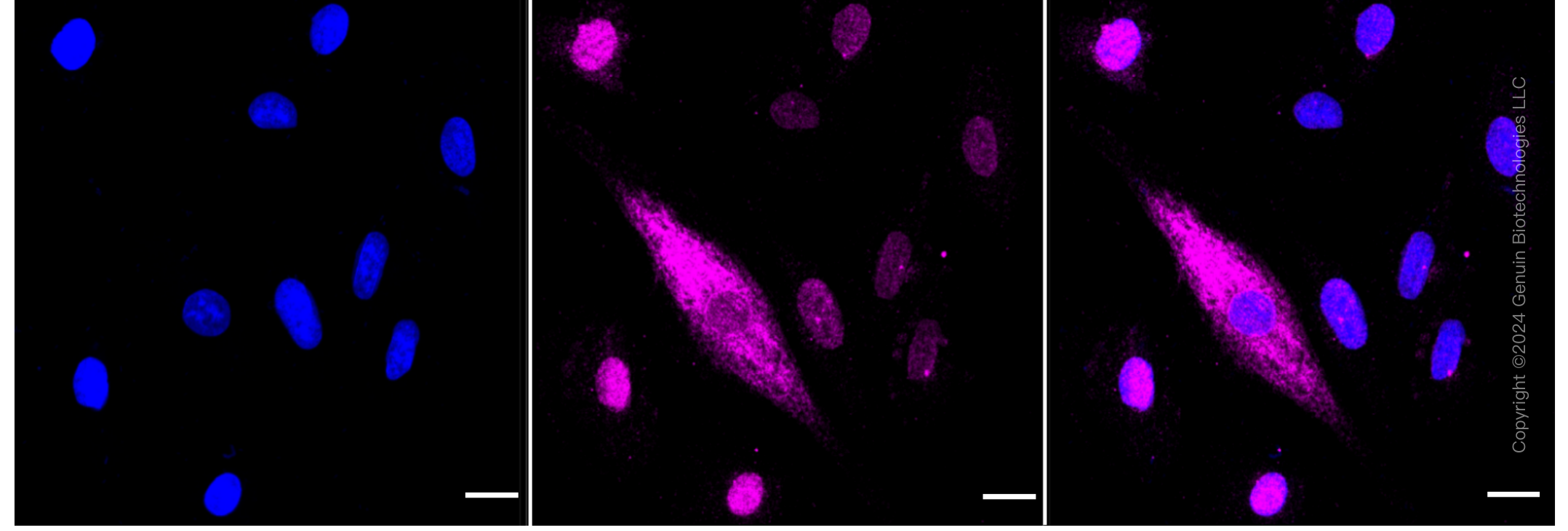 KD-Validated Anti-Keratin 4 Rabbit Monoclonal Antibody ABG1551