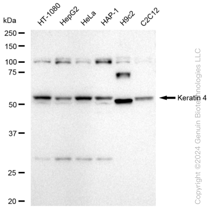 KD-Validated Anti-Keratin 4 Rabbit Monoclonal Antibody ABG1551
