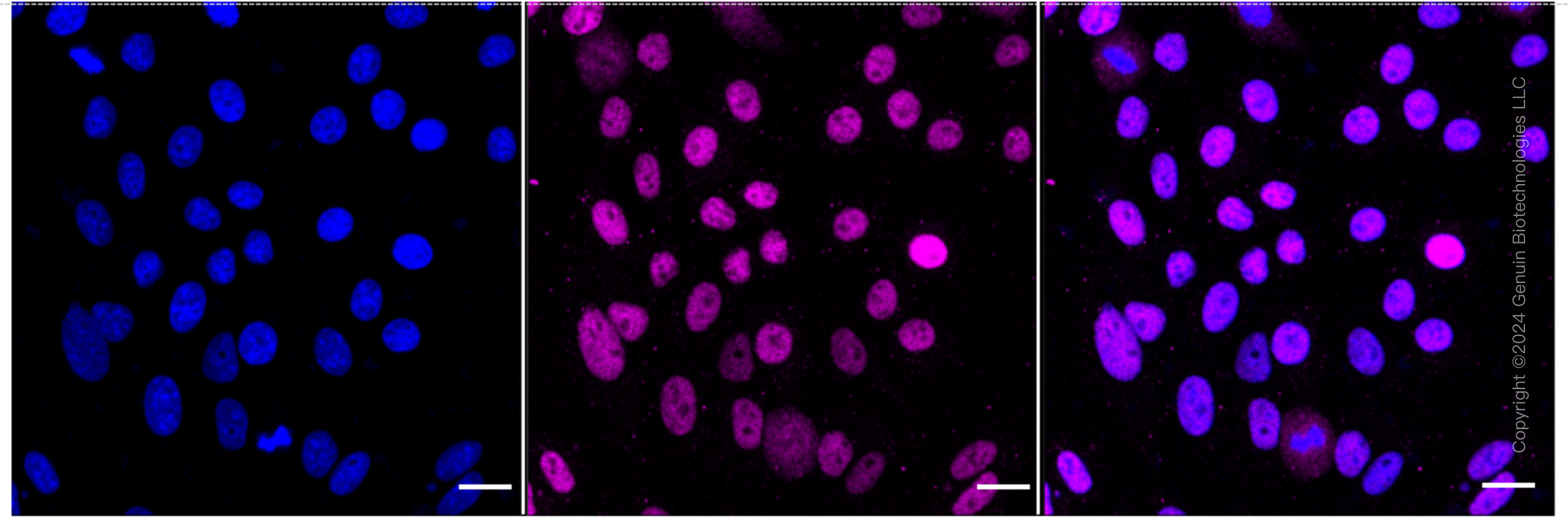 KD-Validated Anti-Lysine demethylase 1B Rabbit Monoclonal Antibody ABG1557