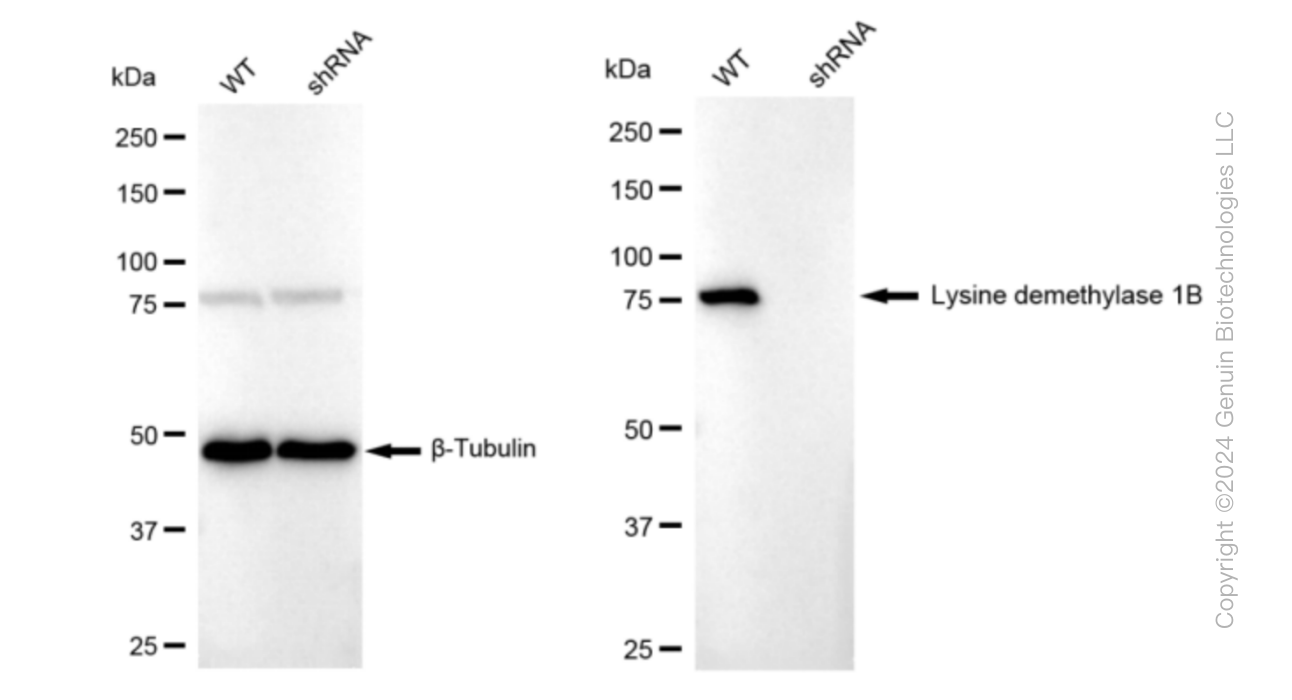 KD-Validated Anti-Lysine demethylase 1B Rabbit Monoclonal Antibody ABG1557