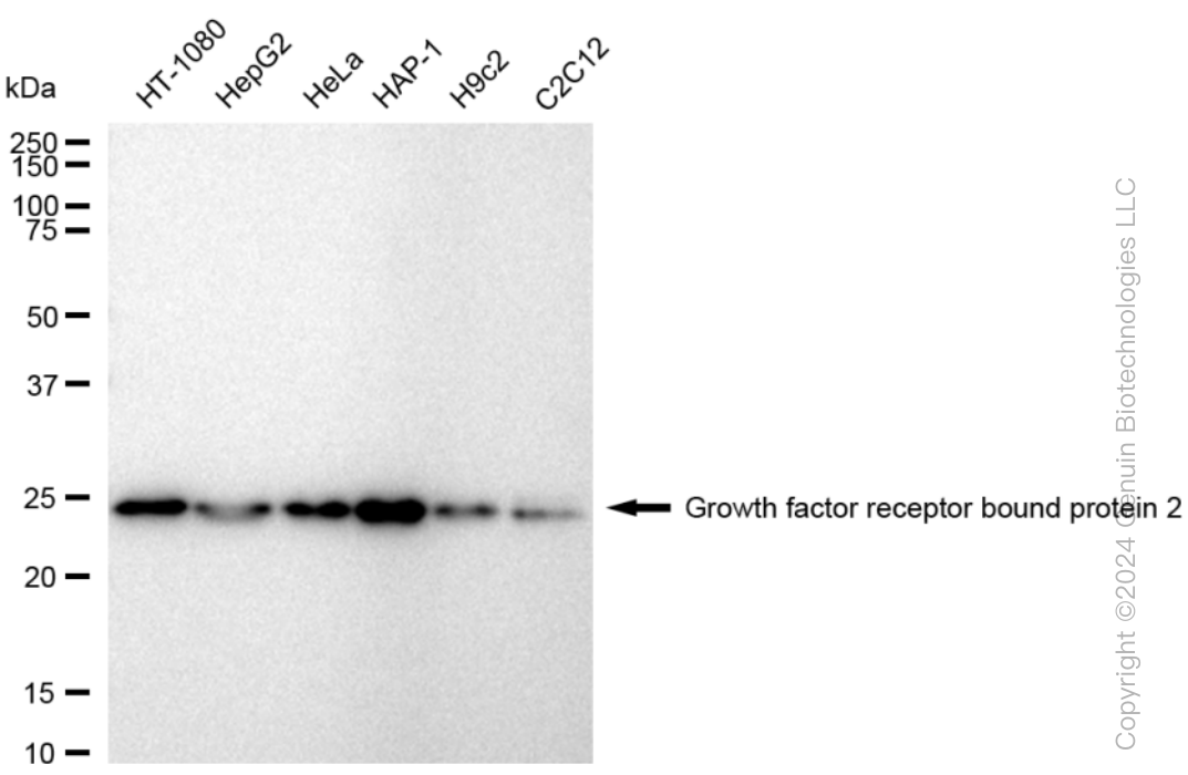 KD-Validated Anti-Growth factor receptor bound protein 2 Rabbit Monoclonal Antibody ABG1558