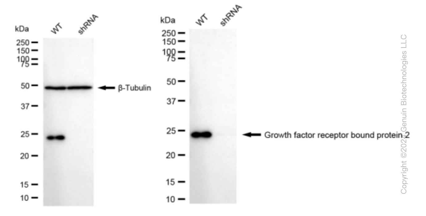 KD-Validated Anti-Growth factor receptor bound protein 2 Rabbit Monoclonal Antibody ABG1558