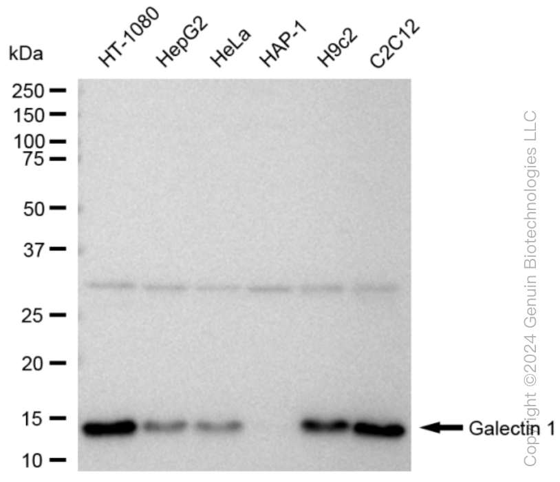 KD-Validated Anti-Galectin 1 Rabbit Monoclonal Antibody ABG1559