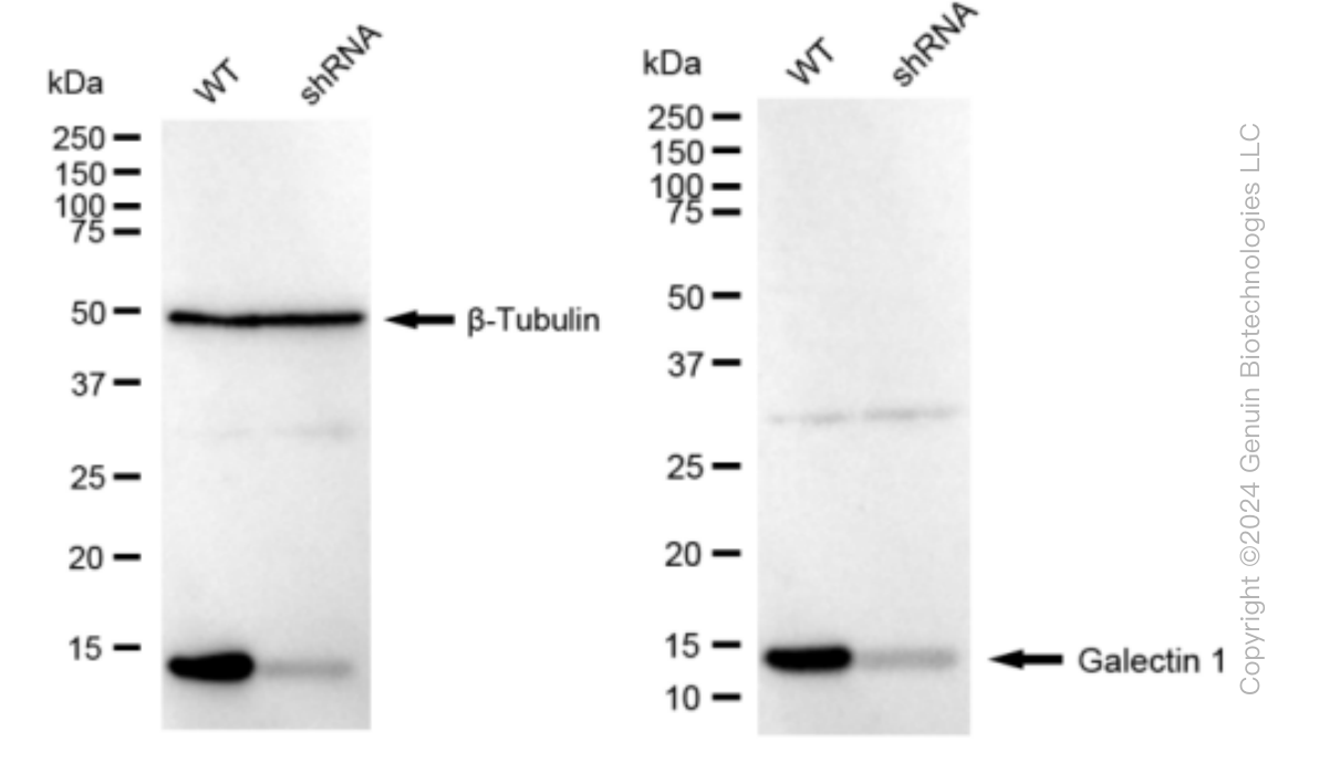 KD-Validated Anti-Galectin 1 Rabbit Monoclonal Antibody ABG1559