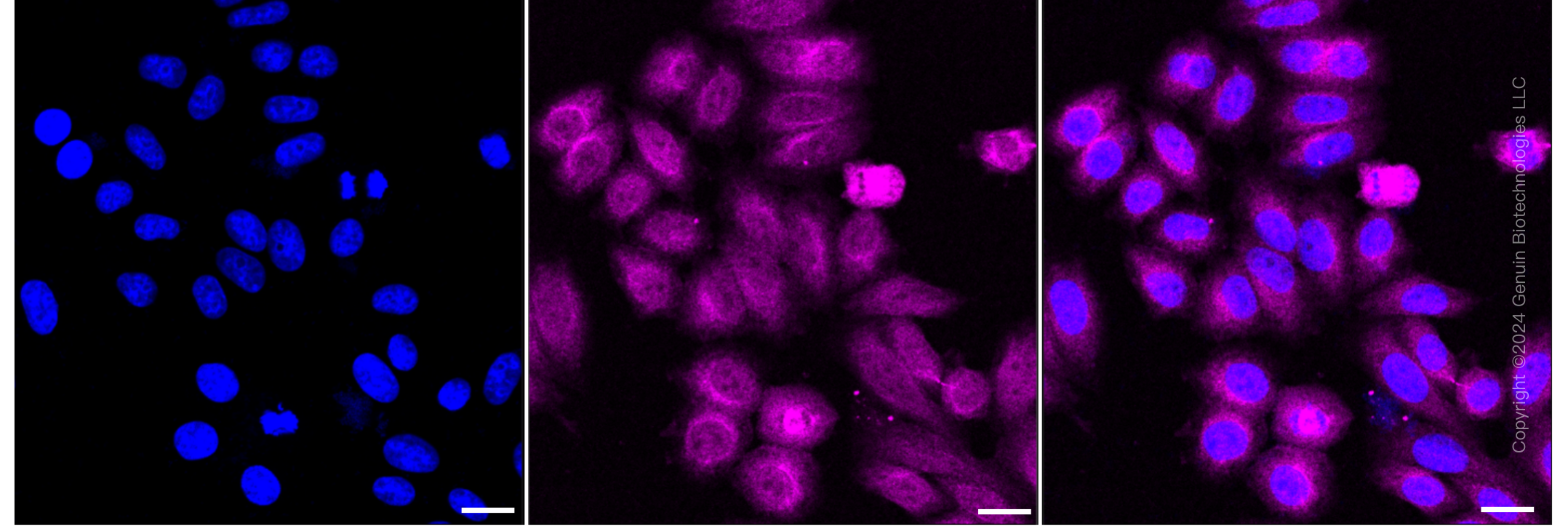 KD-Validated Anti-Huntingtin Rabbit Monoclonal Antibody ABG1560