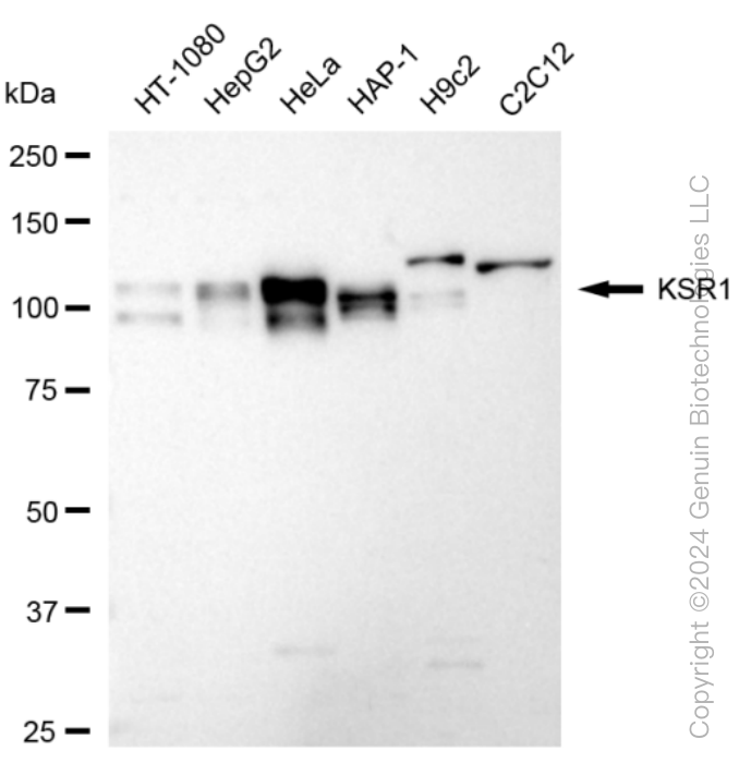 KD-Validated Anti-KSR1 Rabbit Monoclonal Antibody ABG1561