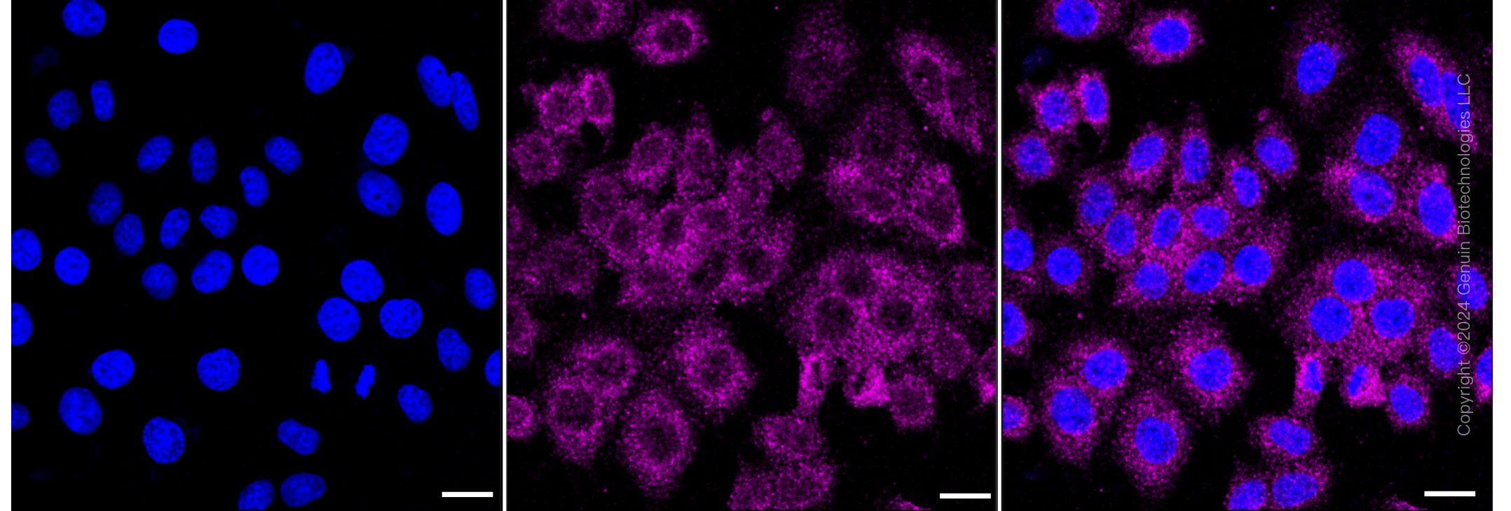 KD-Validated Anti-IGF2BP3 Rabbit Monoclonal Antibody ABG1562