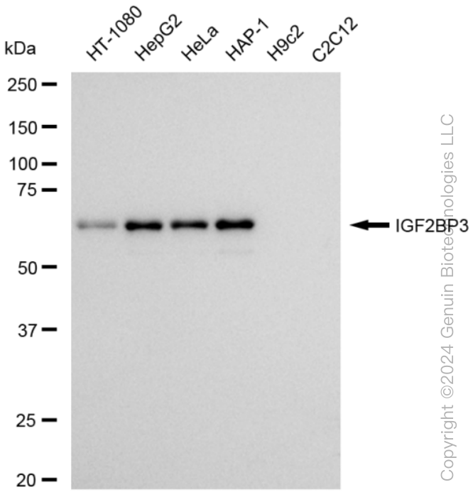 KD-Validated Anti-IGF2BP3 Rabbit Monoclonal Antibody ABG1562