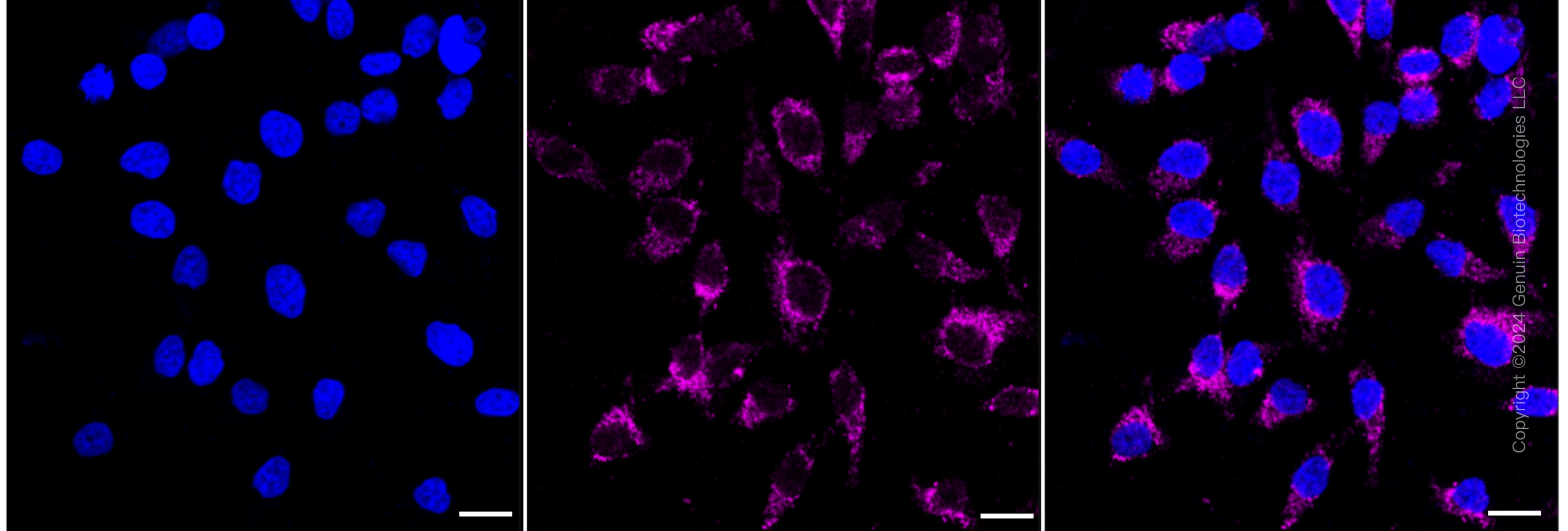 KD-Validated Anti-Keratin 17 Rabbit Monoclonal Antibody ABG1569