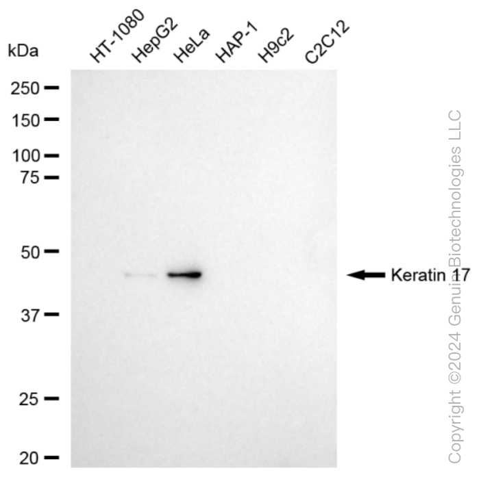 KD-Validated Anti-Keratin 17 Rabbit Monoclonal Antibody ABG1569