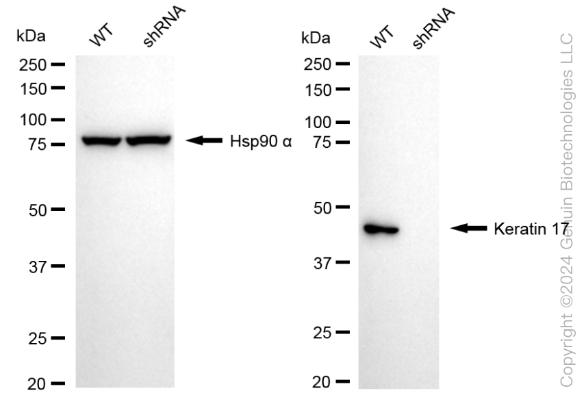 KD-Validated Anti-Keratin 17 Rabbit Monoclonal Antibody ABG1569