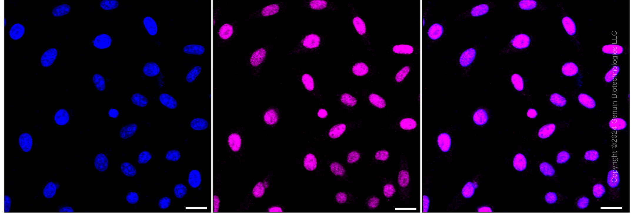 KD-Validated Anti-Phospho-JunD (S255) Rabbit Monoclonal Antibody ABG1570