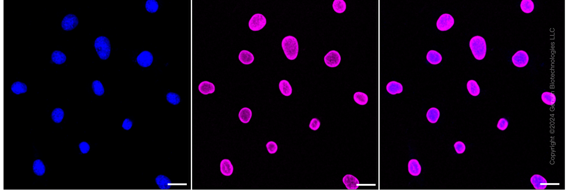 KD-Validated Anti-E2F transcription factor 1 Rabbit Monoclonal Antibody ABG1572