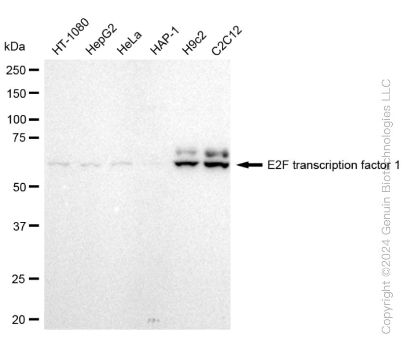 KD-Validated Anti-E2F transcription factor 1 Rabbit Monoclonal Antibody ABG1572