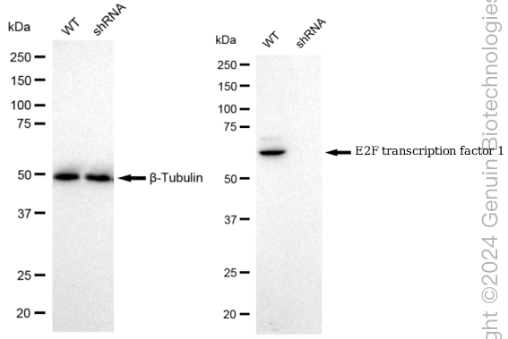 KD-Validated Anti-E2F transcription factor 1 Rabbit Monoclonal Antibody ABG1572